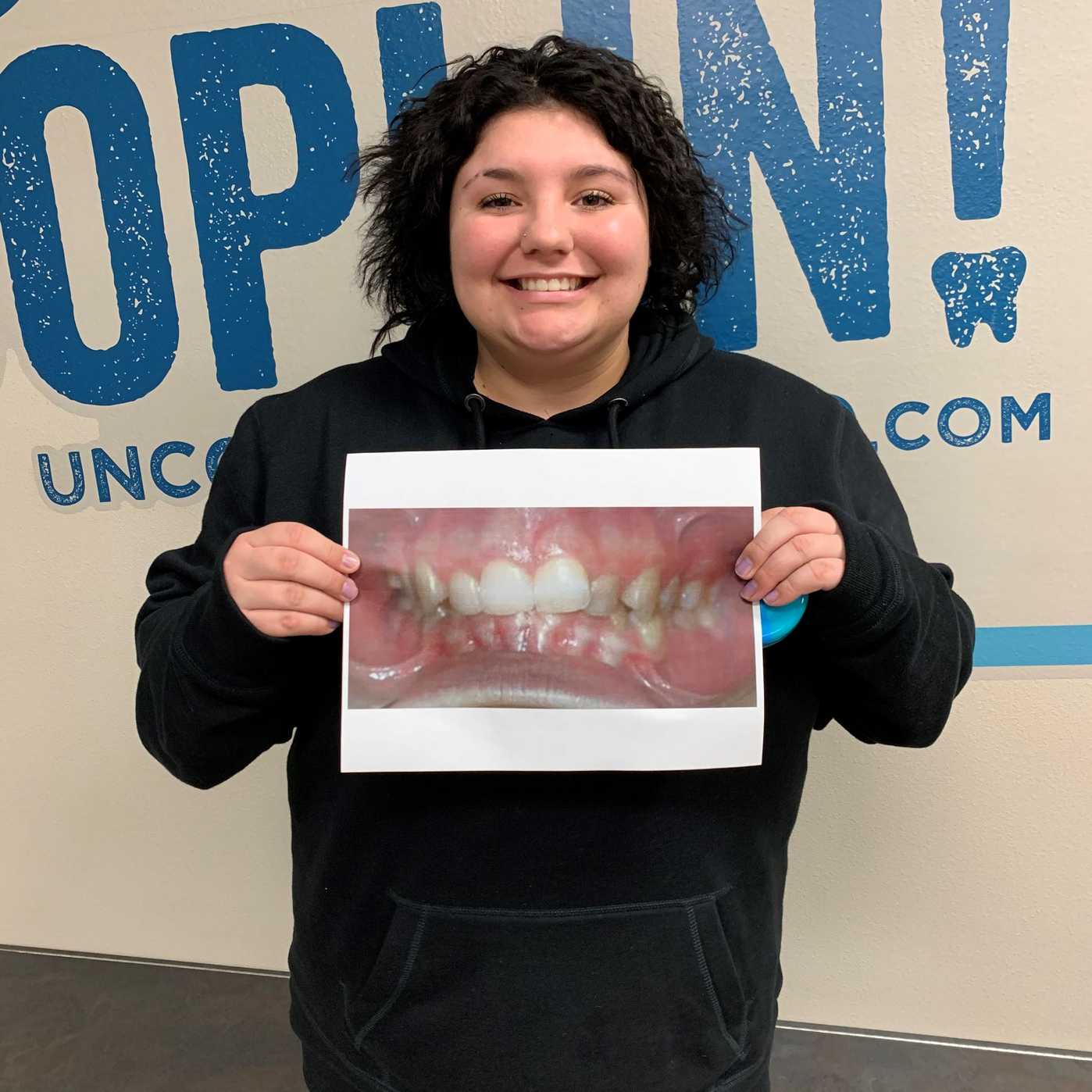 How Old Do You Have to Be to Get Braces? | Uncommon Ortho