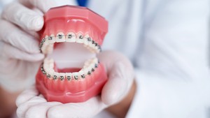 how orthodontics shapes your facial structure
