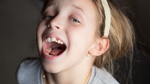 early interceptive orthodontics,
orthodontic interceptive treatment and early orthodontics