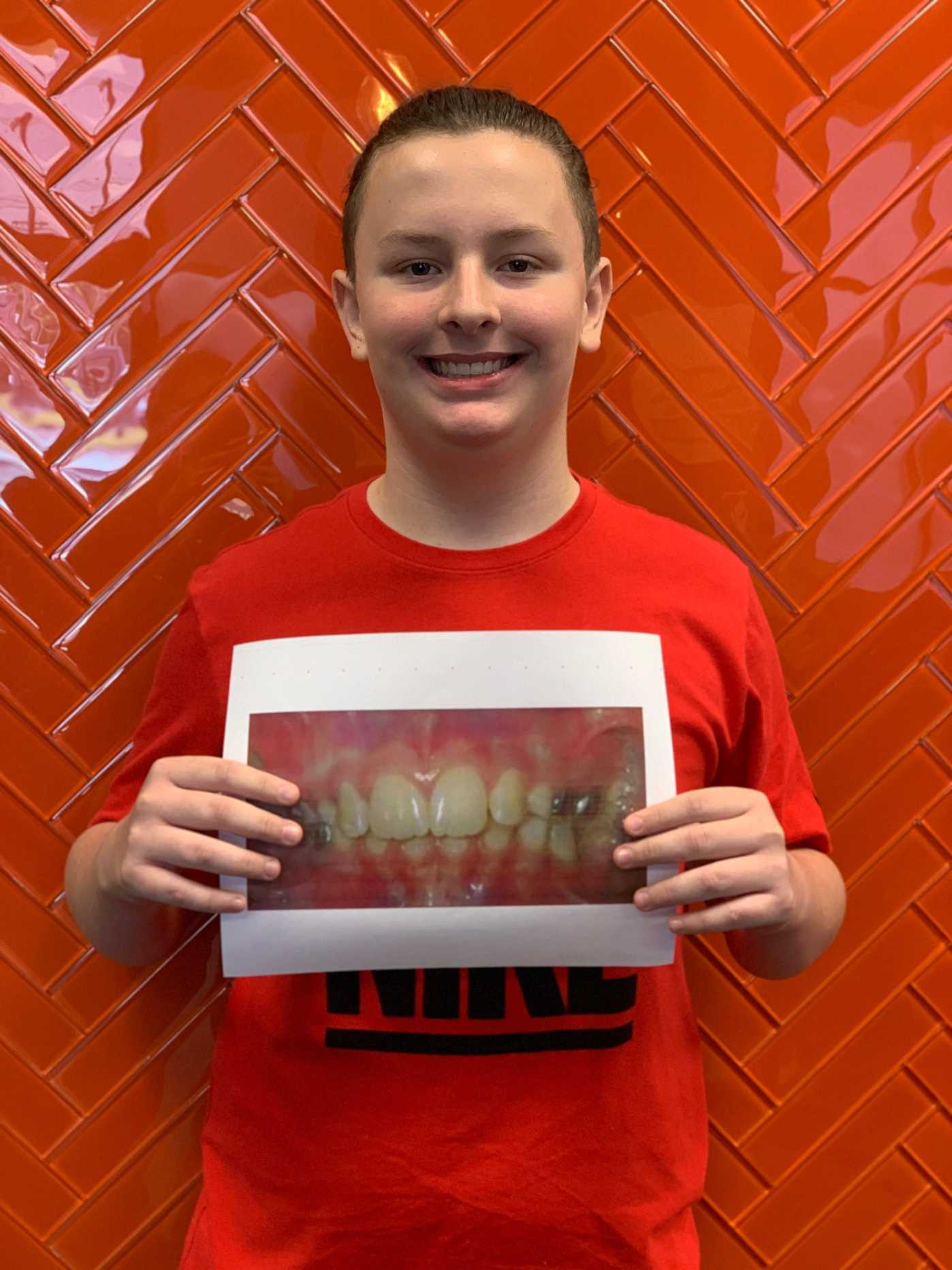 Braces & Invisalign® in Joplin, MO Orthodontics