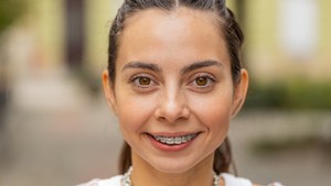 1st day with braces, how long does it take to get used to braces and what do braces feel like