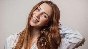 How long does it take to get braces?