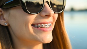 Braces Airport Drive