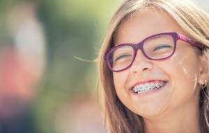 benefits of traditional metal braces