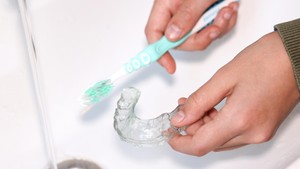 retainer cleaning, how to clean your retainer, how do i clean my retainers, How Often Should I Clean My Retainer?