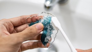 The Retainer Deep Clean Guide