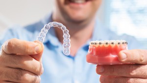 All About Braces and Invisalign